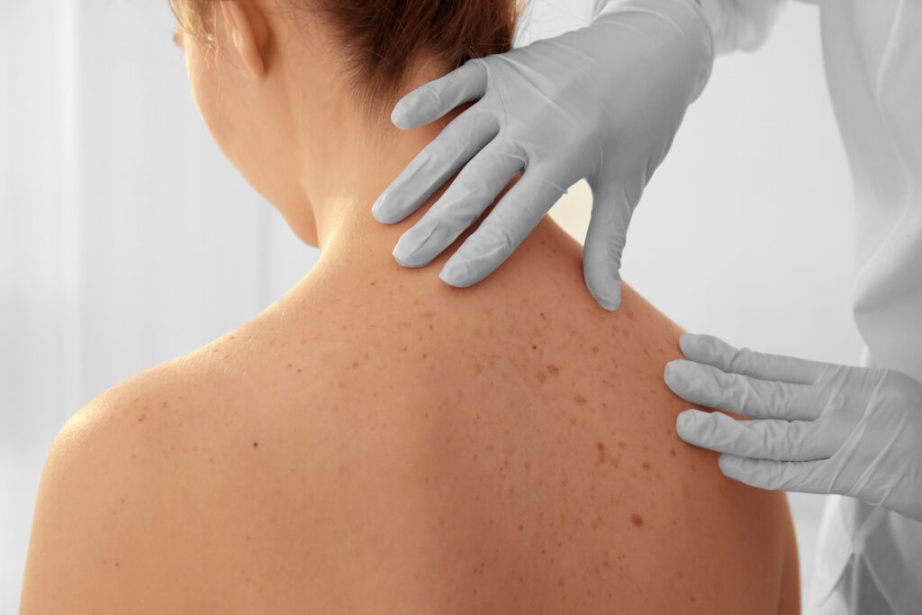 skin marceau - dermatologie et épilation laser